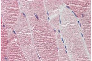 Human Skeletal Muscle: Formalin-Fixed, Paraffin-Embedded (FFPE)