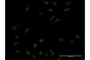 Immunofluorescence of monoclonal antibody to KLF10 on HeLa cell.