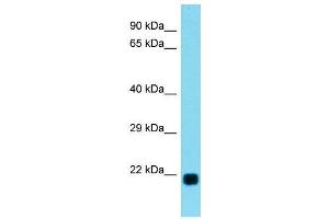 Host:  Rabbit  Target Name:  Lbx2  Sample Type:  Rat Heart lysates  Antibody Dilution:  1. (LBX2 anticorps  (C-Term))