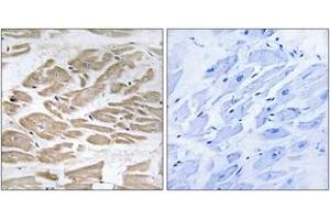 Immunohistochemistry analysis of paraffin-embedded human heart tissue, using BRP44L Antibody. (BRP44L anticorps  (AA 11-60))