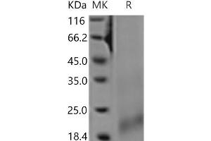 Western Blotting (WB) image for Tumor Necrosis Factor Receptor Superfamily, Member 13C (TNFRSF13C) protein (His tag) (ABIN7321204)