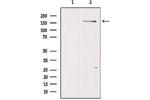 Western blot analysis of extracts from Mouse Myeloma cell, using BAI1 Antibody.