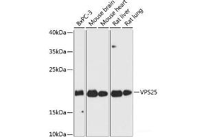 Western blot analysis of extracts of various cell lines using VPS25 Polyclonal Antibody at dilution of 1:3000. (VPS25 anticorps)