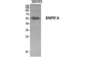Western Blot (WB) analysis of SKOV3 cells using CD292 Polyclonal Antibody. (BMPR1A anticorps  (Internal Region))