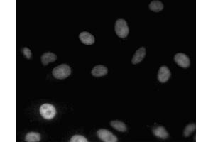 Immunofluorescent staining of A549 (ATCC CCL-185) cells. (MDM2 anticorps  (AA 154-167))