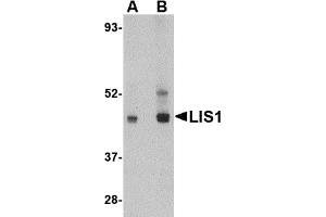 Western Blotting (WB) image for anti-Platelet-Activating Factor Acetylhydrolase 1b, Regulatory Subunit 1 (45kDa) (PAFAH1B1) (C-Term) antibody (ABIN1030486) (PAFAH1B1 anticorps  (C-Term))