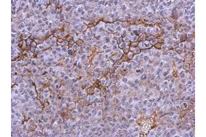 IHC-P Image Immunohistochemical analysis of paraffin-embedded PC13 xenograft, using CD41, antibody at 1:500 dilution. (Integrin Alpha2b anticorps  (Internal Region))