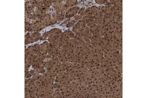 Immunohistochemical staining of human pancreas with UBXN6 polyclonal antibody  shows strong nuclear and cytoplasmic positivity in exocrine glandular cells at 1:20-1:50 dilution. (UBXN6 anticorps)