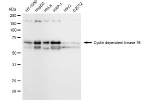 Western blotting analysis using Cyclin dependent kinase 16 antibody (ABIN7798208). (Recombinant CDK16 anticorps)