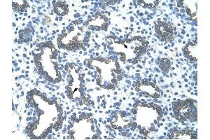 GNAS antibody was used for immunohistochemistry at a concentration of 4-8 ug/ml to stain Alveolar cells (arrows) in Human Lung. (GNAS anticorps  (N-Term))