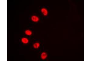 Immunofluorescent analysis of NR2F2 staining in HeLa cells. (NR2F2 anticorps  (N-Term))