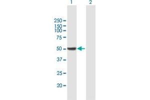 Western Blot analysis of ALDH9A1 expression in transfected 293T cell line by ALDH9A1 MaxPab polyclonal antibody. (ALDH9A1 anticorps  (AA 1-494))