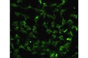 Immunofluorescence analysis of CA9 antibody with HeLa cells.