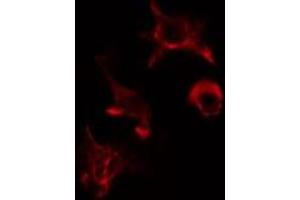 ABIN6275563 staining HuvEc cells by IF/ICC. (SH2B2 anticorps  (N-Term))