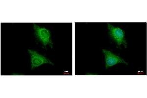 ICC/IF Image Laforin antibody [C2C3], C-term detects EPM2A protein at cytoplasm by immunofluorescent analysis. (EPM2A anticorps  (C-Term))