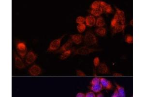 Immunofluorescence analysis of HeLa cells using SLC16A4 Polyclonal Antibody at dilution of 1:100. (SLC16A4 anticorps)