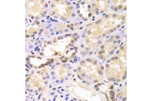 Immunohistochemistry of paraffin-embedded human kidney using PSMC6 antibody (ABIN5973113) at dilution of 1/100 (40x lens). (PSMC6 anticorps)