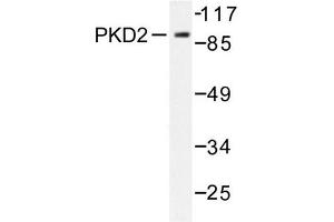 Image no. 1 for anti-Protein Kinase D2 (PKD2) antibody (ABIN272069) (PKD2 anticorps)