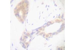 Image no. 1 for anti-Tumor Necrosis Factor alpha (TNF alpha) antibody (ABIN465674) (TNF alpha anticorps)