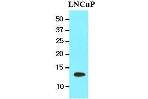Cell lysates of LnitrocelluloseaP(20 ug) were resolved by SDS-PAGE, transferred to nitrocellulose membrane and probed with anti-human TBCA (1:1000).