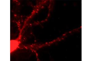 Immunofluorescence labeling of a hippocampus neuron (dilution 1 : 500).