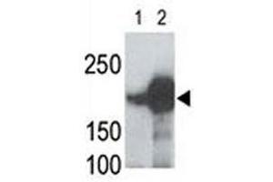 LRP5 antibody used in western blot to detect recombinant human LRP5 (Lane 1) and mouse LRP5 (2) proteins in transfected 293 cell lysate; Data is kindly provided by Drs. (LRP5 anticorps  (AA 1538-1567))