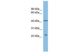 RALB antibody used at 1 ug/ml to detect target protein. (RALB anticorps)