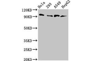 Western Blot Positive WB detected in: Hela whole cell lysate, 293 whole cell lysate, A549 whole cell lysate, HepG2 whole cell lysate All lanes: MACC1 antibody at 3 μg/mL Secondary Goat polyclonal to rabbit IgG at 1/50000 dilution Predicted band size: 97 kDa Observed band size: 97 kDa (MACC1 anticorps  (AA 371-514))
