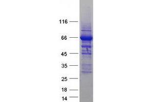 Validation with Western Blot