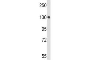 Western blot analysis of CP antibody and mouse lung tissue lysate.