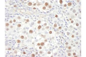 anti-Minichromosome Maintenance Deficient 4 (MCM4) (AA 325-375) antibody