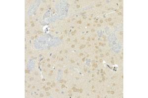 Immunohistochemistry of paraffin-embedded rat brain using CNTN4 Rabbit mAb (ABIN7266495) at dilution of 1:100 (40x lens). (Contactin 4 anticorps)