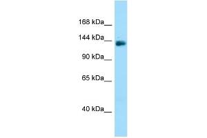 WB Suggested Anti-PPP1R9A Antibody Titration: 1.