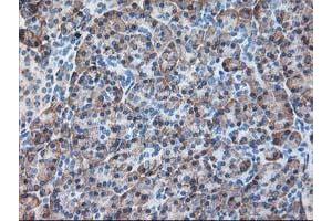 Image no. 3 for anti-Ribophorin 1 (RPN1) antibody (ABIN1500748) (RPN1 anticorps)