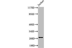 Western Blot analysis of Jurkat cells using Cleaved-Tumstatin (P1426) Polyclonal Antibody (COL4a3 anticorps  (Cleaved-Pro1426))