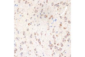 Immunohistochemistry of paraffin-embedded mouse brain using CYPOR Rabbit mAb (ABIN7269151) at dilution of 1:100 (40x lens). (POR anticorps)