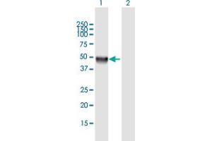 Western Blot analysis of CLN5 expression in transfected 293T cell line by CLN5 MaxPab polyclonal antibody. (CLN5 anticorps  (AA 1-407))
