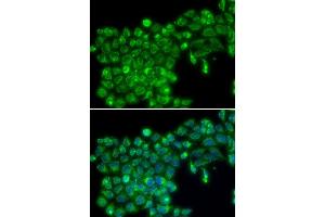 Immunofluorescence analysis of MCF7 cell using TNFSF13 antibody. (TNFSF13 anticorps  (AA 105-247))