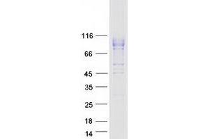 Validation with Western Blot
