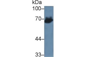 Rabbit Detection antibody from the kit in WB with Positive Control: Human lung lysate. (alpha Fetoprotein Kit CLIA)