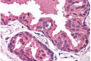 Human Prostate (formalin-fixed, paraffin-embedded) stained with EGLN2 antibody ABIN214100 at 5 ug/ml followed by biotinylated goat anti-rabbit IgG secondary antibody ABIN481713, alkaline phosphatase-streptavidin and chromogen.