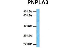 Host:  Rabbit  Target Name:  PNPLA3  Sample Tissue:  Human Jurkat  Antibody Dilution:  1.