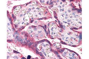 Anti-RYBP antibody IHC of human placenta. (RYBP anticorps  (AA 71-120))