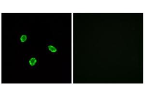 Immunofluorescence analysis of A549 cells, using SSTR1 antibody. (SSTR1 anticorps  (N-Term))