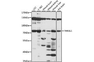 Western blot analysis of extracts of various cell lines, using THNSL1 antibody (ABIN7270815) at 1:1000 dilution.