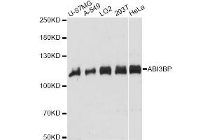 Western blot analysis of extracts of various cell lines, using ABI3BP antibody. (ABI3BP anticorps)
