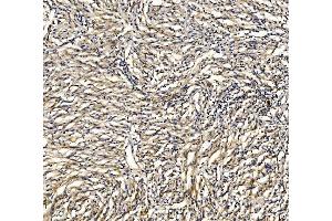 IHC analysis of GRID2 using anti-GRID2 antibody (ABIN7603172). (GRID2 anticorps  (N-Term))