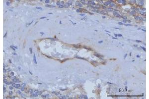 IHC analysis of Thrombomodulin/THBD using anti-Thrombomodulin/THBD antibody (ABIN7601141).