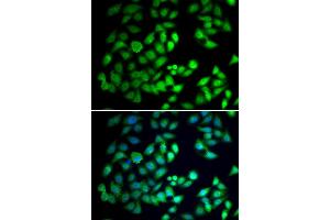 Immunofluorescence analysis of A549 cell using WDR77 antibody. (WDR77 anticorps)