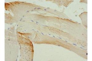 Immunohistochemistry of paraffin-embedded human skeletal muscle tissue using ABIN7163187 at dilution of 1:100 (PIP5K1B anticorps  (AA 190-470))
